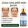 Botox Antiarrugas
